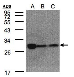 CLPP Antibody - Sample (30 ug of whole cell lysate). A:293T, B: A431, C: H1299. 10% SDS PAGE. CLPP antibody diluted at 1:1500