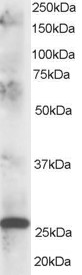 CLPP Antibody - Antibody staining (1 ug/ml) of human muscle lysate (RIPA buffer, 35 ug total protein per lane). Primary incubated for 1 hour. Detected by Western blot of chemiluminescence.
