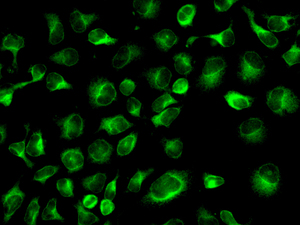 CLPTM1 Antibody - Immunofluorescent staining of HeLa cells using anti-CLPTM1 antibody.