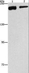 CLTC / Clathrin Heavy Chain Antibody - Western blot analysis of NIH/3T3 and HeLa cell, using CLTC Polyclonal Antibody at dilution of 1:300.