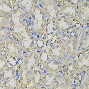 CLTC / Clathrin Heavy Chain Antibody - Immunohistochemistry of paraffin-embedded rat kidney tissue.