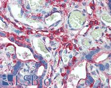 CLTC / Clathrin Heavy Chain Antibody - Human Placenta: Formalin-Fixed, Paraffin-Embedded (FFPE)