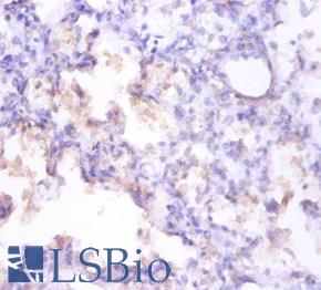 CLU / Clusterin Antibody - Immunohistochemistry of paraffin-embedded human prostate using CLU / Clusterin antibody at dilution of 1:100.  This image was taken for the unconjugated form of this product. Other forms have not been tested.