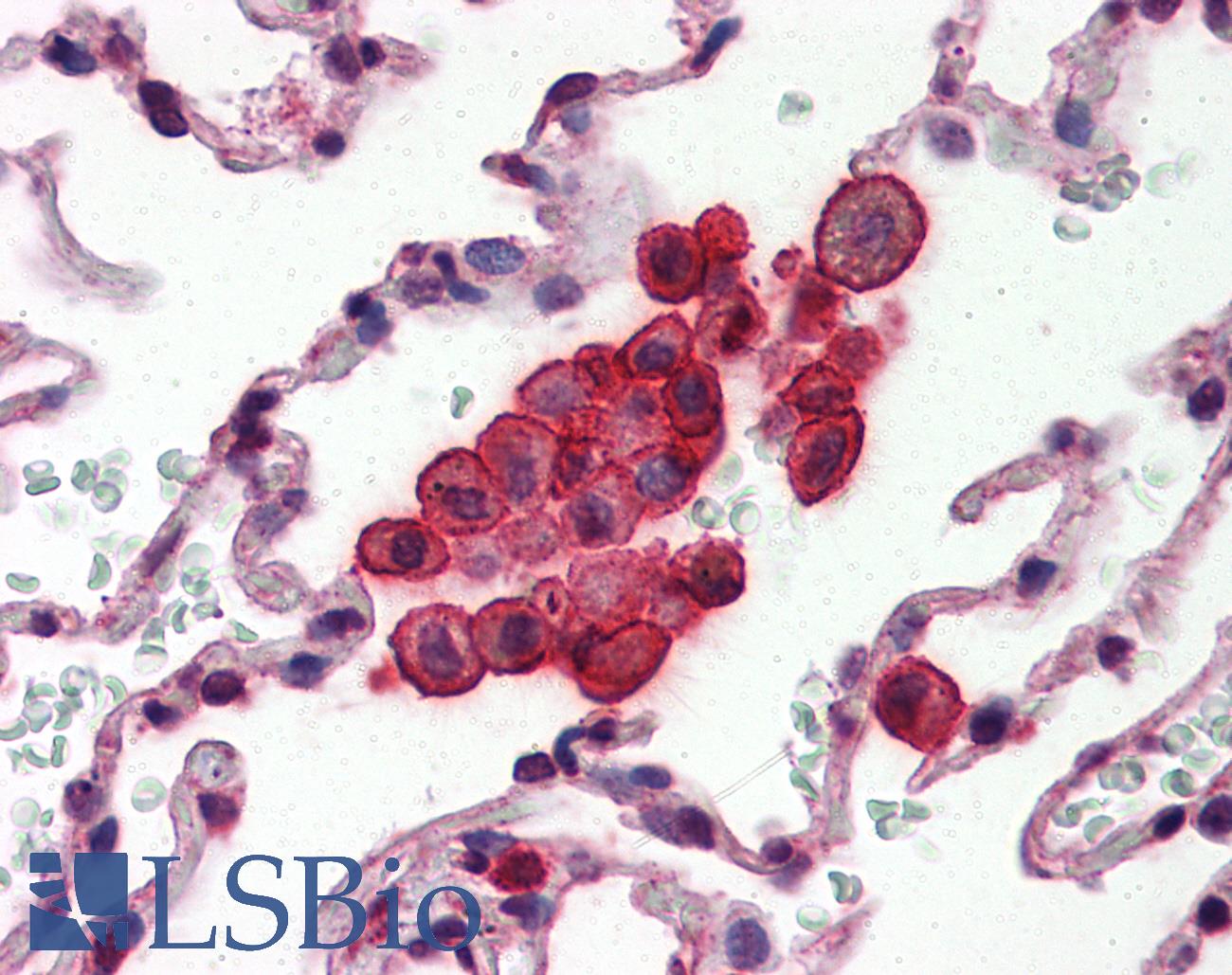 CLU / Clusterin Antibody - Anti-Clusterin antibody IHC of human lung. Immunohistochemistry of formalin-fixed, paraffin-embedded tissue after heat-induced antigen retrieval. Antibody concentration 10 ug/ml.