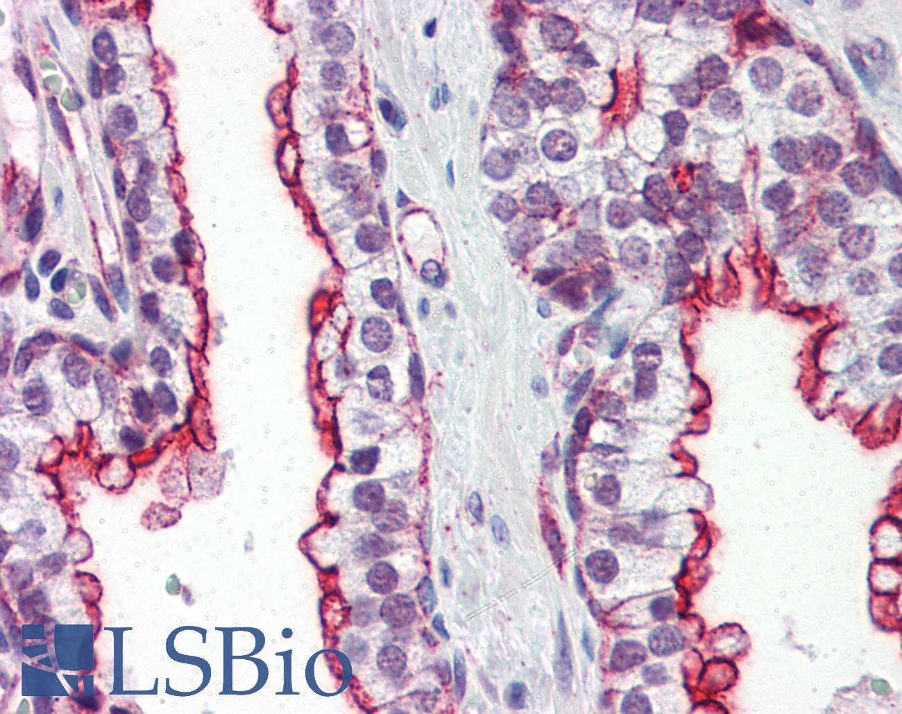 CLU / Clusterin Antibody - Anti-Clusterin antibody IHC of human prostate. Immunohistochemistry of formalin-fixed, paraffin-embedded tissue after heat-induced antigen retrieval. Antibody concentration 10 ug/ml.