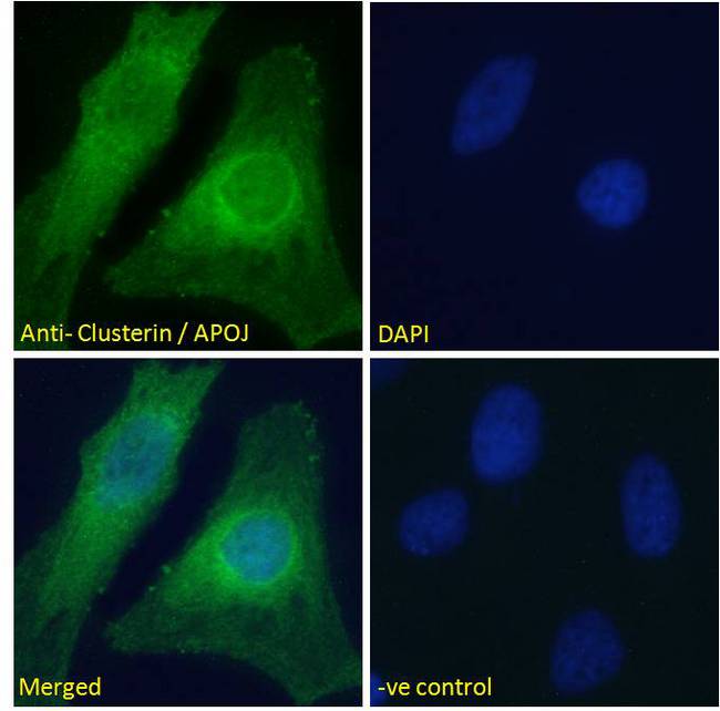 CLU / Clusterin Antibody - CLU / Clusterin antibody immunofluorescence analysis of paraformaldehyde fixed HeLa cells, permeabilized with 0.15% Triton. Primary incubation 1hr (10ug/ml) followed by Alexa Fluor 488 secondary antibody (2ug/ml), showing cytoplasmic staining. The nuclear stain is DAPI (blue). Negative control: Unimmunized goat IgG (10ug/ml) followed by Alexa Fluor 488 secondary antibody (2ug/ml).