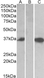 CMA1 / Mast Cell Chymase Antibody - HEK293 lysate (10ug protein in RIPA buffer) over expressing Human CMA1 with DYKDDDDK tag probed with (0.5ug/ml) in Lane A and probed with anti- DYKDDDDK Tag (1/3000) in lane C. Mock-transfected HEK293 probed (1mg/ml) in Lane B. Primary
