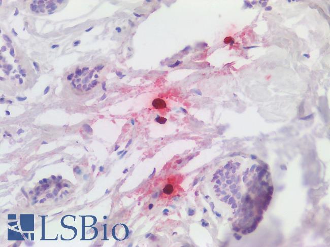 CMA1 / Mast Cell Chymase Antibody - Human Breast: Formalin-Fixed, Paraffin-Embedded (FFPE)