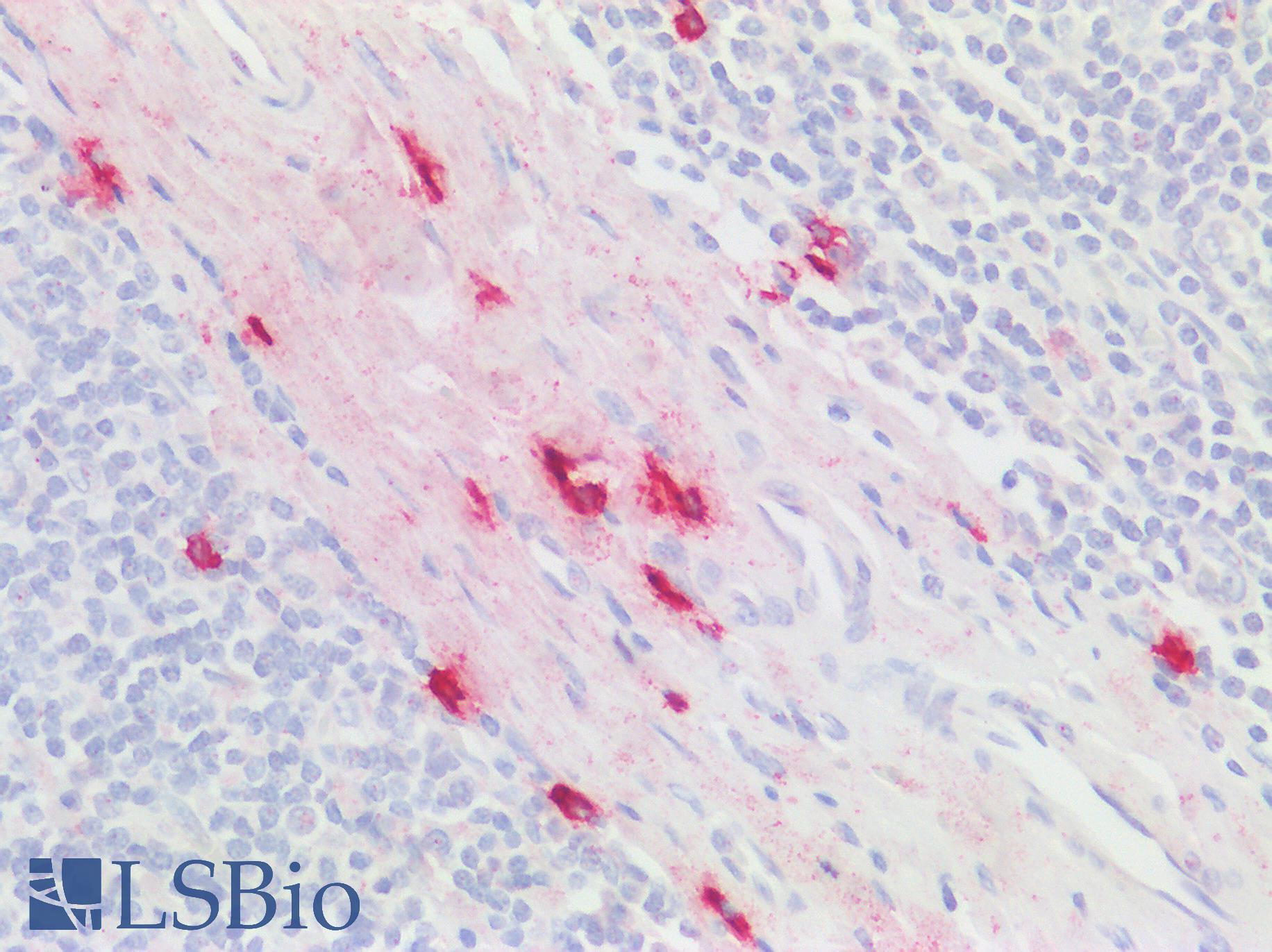 CMA1 / Mast Cell Chymase Antibody - Human Tonsil: Formalin-Fixed, Paraffin-Embedded (FFPE)