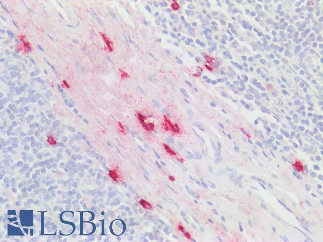 CMA1 / Mast Cell Chymase Antibody - Human Tonsil: Formalin-Fixed, Paraffin-Embedded (FFPE)