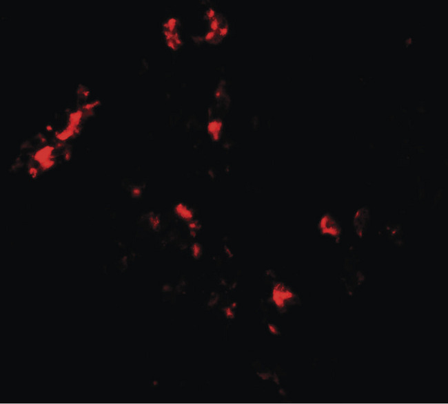 CMPK2 Antibody - Immunofluorescence of CMPK2 in human lung tissue with CMPK2 antibody at 20 ug/ml.