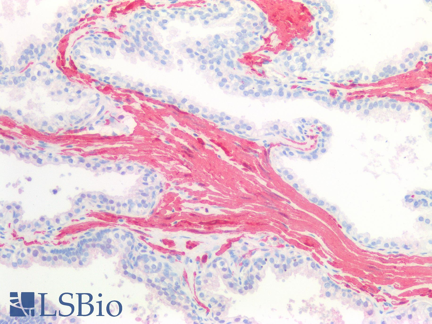 CNN1 / Calponin Antibody - Human Prostate Smooth Muscle: Formalin-Fixed, Paraffin-Embedded (FFPE)