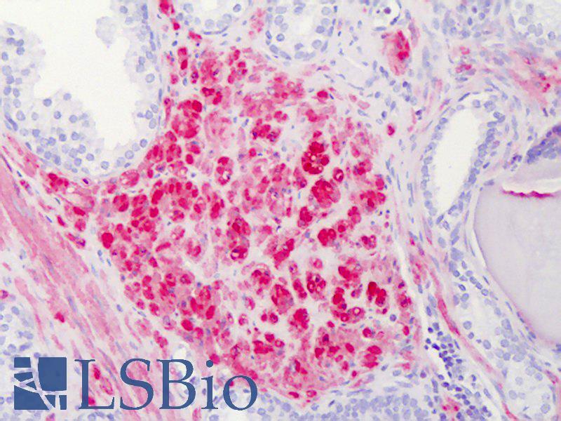 CNN1 / Calponin Antibody - Anti-CNN1 / Calponin antibody IHC of human prostate. Immunohistochemistry of formalin-fixed, paraffin-embedded tissue after heat-induced antigen retrieval. Antibody concentration 5 ug/ml.