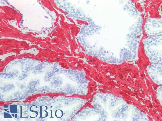 CNN1 / Calponin Antibody - Human Prostate Smooth Muscle: Formalin-Fixed, Paraffin-Embedded (FFPE)