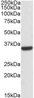 CNN2 Antibody - CNN2 antibody (0.03 ug/ml) staining of HepG2 lysates (35 ug protein/ml in RIPA buffer) with (B) and without (A) blocking with the immunizing peptide. Primary incubation was 1 hour. Detected by chemiluminescence.