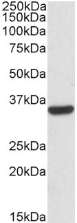 CNN2 Antibody - Calponin 2 / CNN2 antibody (0.03µg/ml) staining of HepG2 lysates (35µg protein in RIPA buffer). Detected by chemiluminescence.