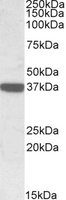 CNN3 Antibody - CNN3 antibody (0.3 ug/ml) staining of Human Duodenum lysate (35 ug protein/ml in RIPA buffer). Primary incubation was 1 hour. Detected by chemiluminescence.