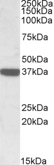 CNN3 Antibody - Calponin 3 / CNN3 antibody (0.3µg/ml) staining of Human Duodenum lysate (35µg protein in RIPA buffer). Detected by chemiluminescence.