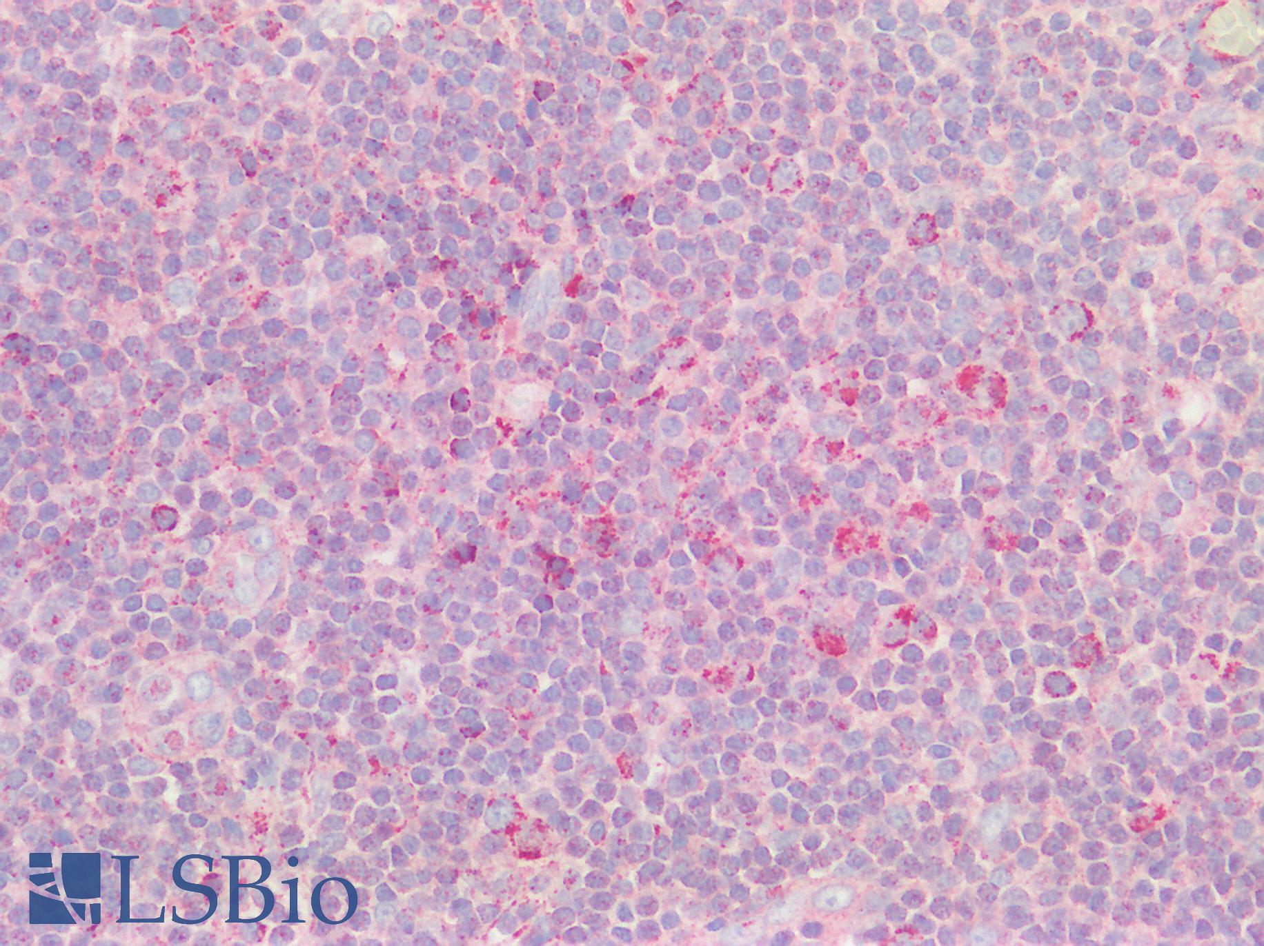 CNOT3 Antibody - Human Tonsil: Formalin-Fixed, Paraffin-Embedded (FFPE)