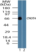 CNOT4 / CLONE243 Antibody - Western blot of CNOT4 in human skeletal muscle lysate in the 1) absence and 2) presence of immunizing peptide using CNOT4 / CLONE243 Antibody at 0.05 ug/ml.