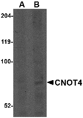 CNOT4 / CLONE243 Antibody - Western blot of CNOT4 in A549 lysate with CNOT4 antibody at (A) 1 and (B) 2 ug/ml.