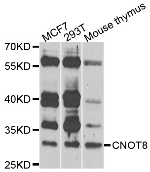 CNOT8 Antibody - Western blot blot of extracts of various cells, using CNOT8 antibody.