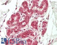 CNOT8 Antibody - Human Breast: Formalin-Fixed, Paraffin-Embedded (FFPE)