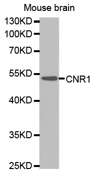 CNR1 / CB1 Antibody - Western blot analysis of extracts of mouse brain tissue lines, using CNR1 antibody.