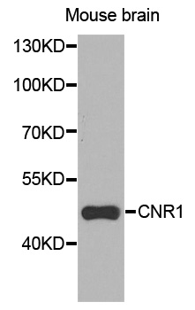 CNR1 / CB1 Antibody - Western blot analysis of extracts of mouse brain cells.
