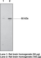CNR1 / CB1 Antibody - Western blot of CB1 antibody.