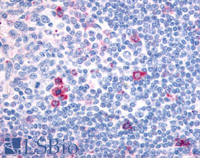 CNR2 / CB2 Antibody - Anti-CNR2 / CB2 antibody IHC of human tonsil, germinal center and mantle zone. Immunohistochemistry of formalin-fixed, paraffin-embedded tissue after heat-induced antigen retrieval.