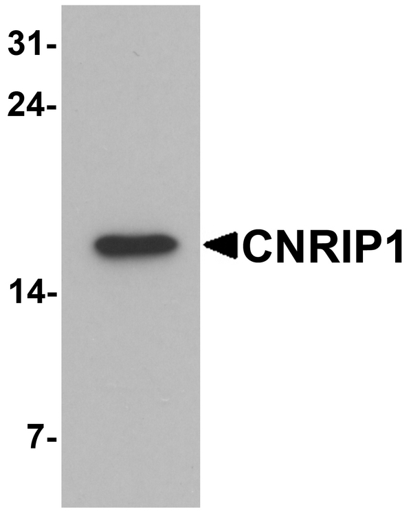 CNRIP1 Antibody - Western blot analysis of CNRIP1 in human brain tissue lysate with CNRIP1 antibody at 1 ug/ml.