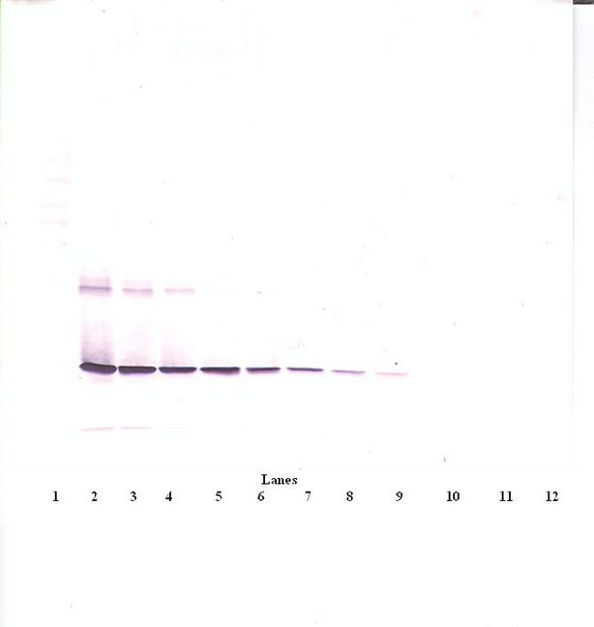 CNTF Antibody - Western Blot (reducing) of CNTF antibody
