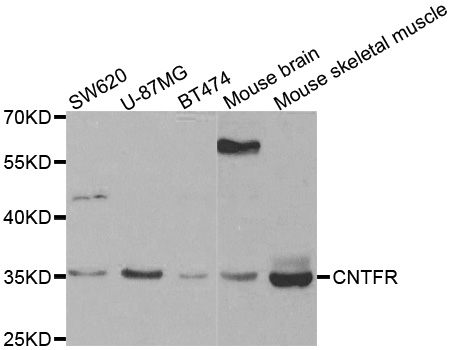 CNTFR Antibody - Western blot analysis of extracts of various cell lines, using CNTFR antibody.