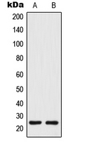 CO-029 / TSPAN8 Antibody - Western blot analysis of Tetraspanin 8 expression in human colon (A); COLO205 (B) whole cell lysates.