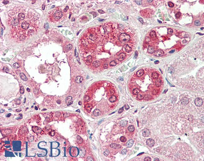 COG8 Antibody - Anti-COG8 antibody IHC staining of human kidney. Immunohistochemistry of formalin-fixed, paraffin-embedded tissue after heat-induced antigen retrieval. Antibody concentration 5 ug/ml.