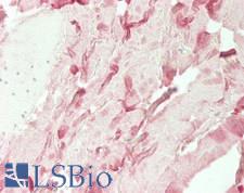 COL1A2 / Collagen I Alpha 2 Antibody - Human Skin, Dermal Collagen: Formalin-Fixed, Paraffin-Embedded (FFPE)