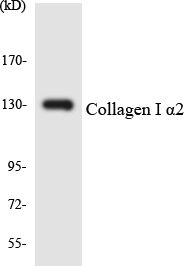 COL1A2 / Collagen I Alpha 2 Antibody - Western blot analysis of the lysates from 293 cells using Collagen I Î±2 antibody.