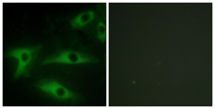 COL1A2 / Collagen I Alpha 2 Antibody - Immunofluorescence analysis of HeLa cells, using Collagen I alpha2 Antibody. The picture on the right is blocked with the synthesized peptide.
