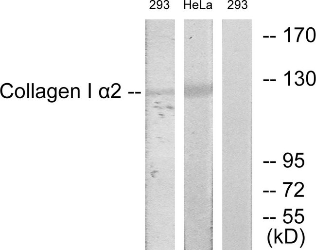 COL1A2 / Collagen I Alpha 2 Antibody - Western blot analysis of lysates from 293 and HeLa cells, using Collagen I alpha2 Antibody. The lane on the right is blocked with the synthesized peptide.