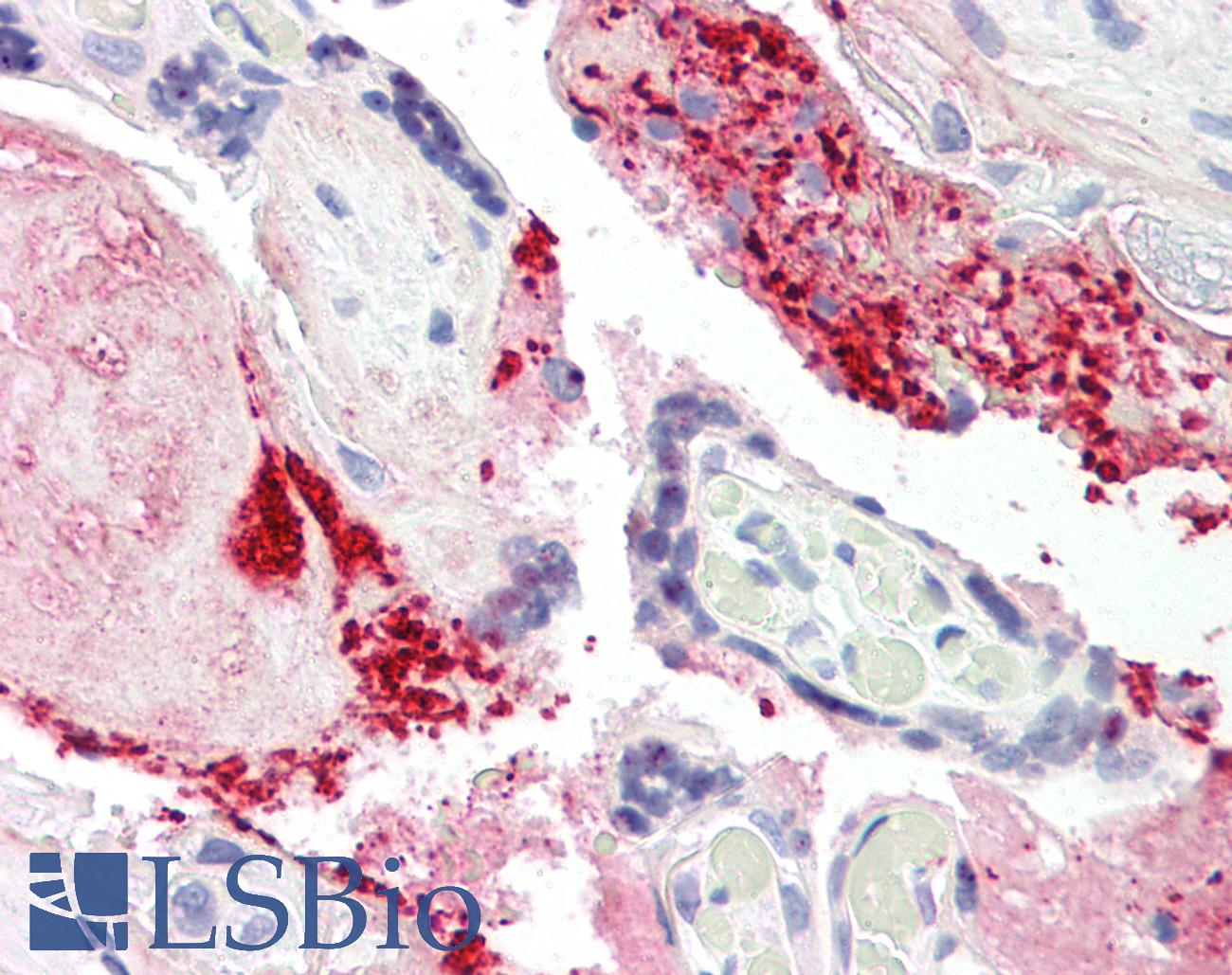 COL1A2 / Collagen I Alpha 2 Antibody - Anti-COL1A2 antibody IHC of human placenta. Immunohistochemistry of formalin-fixed, paraffin-embedded tissue after heat-induced antigen retrieval. Antibody dilution 5 ug/ml.