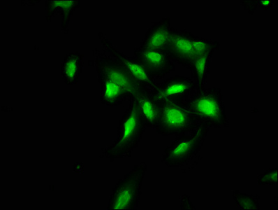 COL4A1 / Collagen IV Alpha1 Antibody - Immunofluorescence staining of U251 cells with COL4A1 Antibody at 1:100, counter-stained with DAPI. The cells were fixed in 4% formaldehyde, permeabilized using 0.2% Triton X-100 and blocked in 10% normal Goat Serum. The cells were then incubated with the antibody overnight at 4°C. The secondary antibody was Alexa Fluor 488-congugated AffiniPure Goat Anti-Rabbit IgG(H+L).