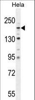 COL4A2 / Collagen IV Alpha2 Antibody - COL4A2 Antibody western blot of HeLa cell line lysates (35 ug/lane). The COL4A2 antibody detected the COL4A2 protein (arrow).