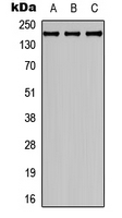 COL4A2 / Collagen IV Alpha2 Antibody - Western blot analysis of Collagen 4 alpha 2 expression in SHSY5Y (A); HEK293T (B); NIH3T3 (C) whole cell lysates.