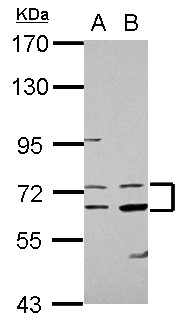 COL4A3BP / CERT Antibody - Sample (30 ug of whole cell lysate) A: A431 B: HeLa 7.5% SDS PAGE COL4A3BP antibody diluted at 1:5000