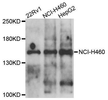 COL4A5 / Collagen IV Alpha5 Antibody - Western blot analysis of extracts of various cells.