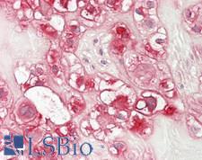 COL5A1 / Collagen V Alpha 1 Antibody - Human Placenta: Formalin-Fixed, Paraffin-Embedded (FFPE)