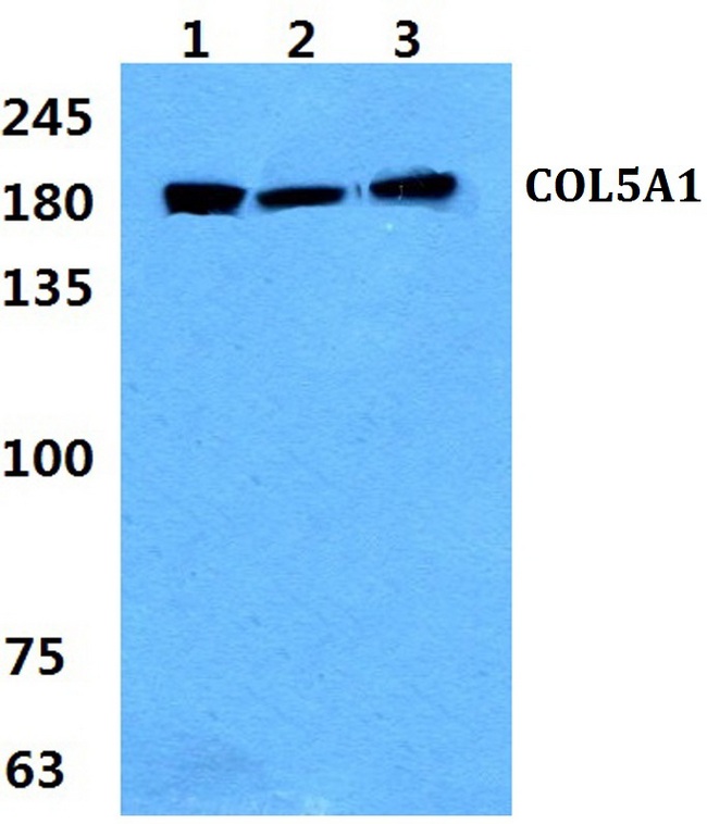 COL5A1 / Collagen V Alpha 1 Antibody - Western blot analysis of COL5A1 pAb at 1:500 dilution. Lane 1: Jurkat cell lysate. Lane 2: Mouse liver tissue lysate. Lane 3: Rat liver tissue lysate.