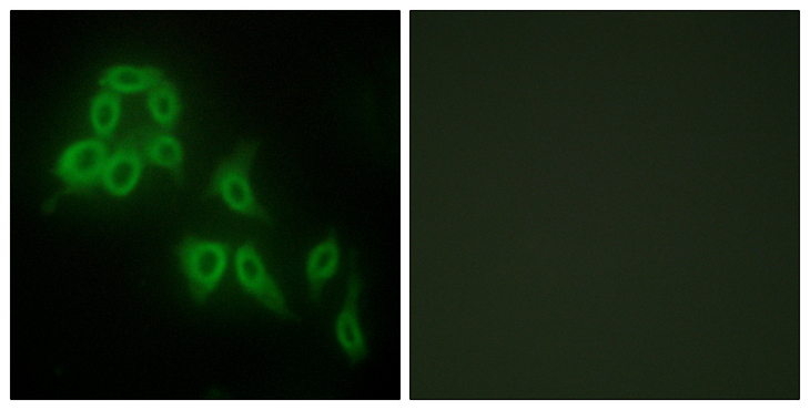 COL5A2 / Collagen V Alpha 2 Antibody - Immunofluorescence analysis of HepG2 cells, using Collagen V alpha2 Antibody. The picture on the right is blocked with the synthesized peptide.