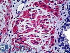 COL5A2 / Collagen V Alpha 2 Antibody - Anti-COL5A2 antibody IHC of human prostate. Immunohistochemistry of formalin-fixed, paraffin-embedded tissue after heat-induced antigen retrieval. Antibody dilution 1:100.